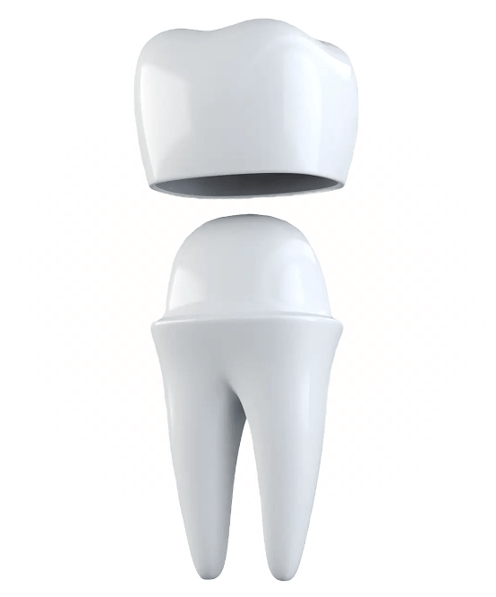 Illustration of a restored tooth